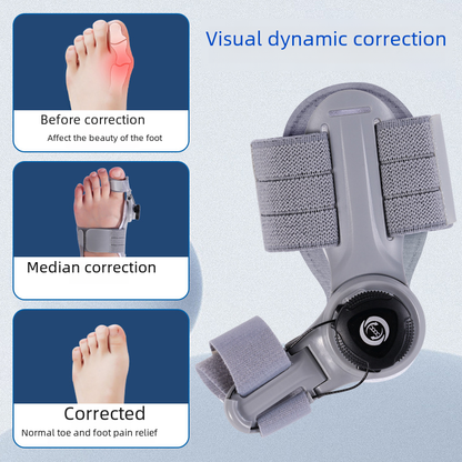 Upgraded Adjustable Bunion Corrector - Freshdropps